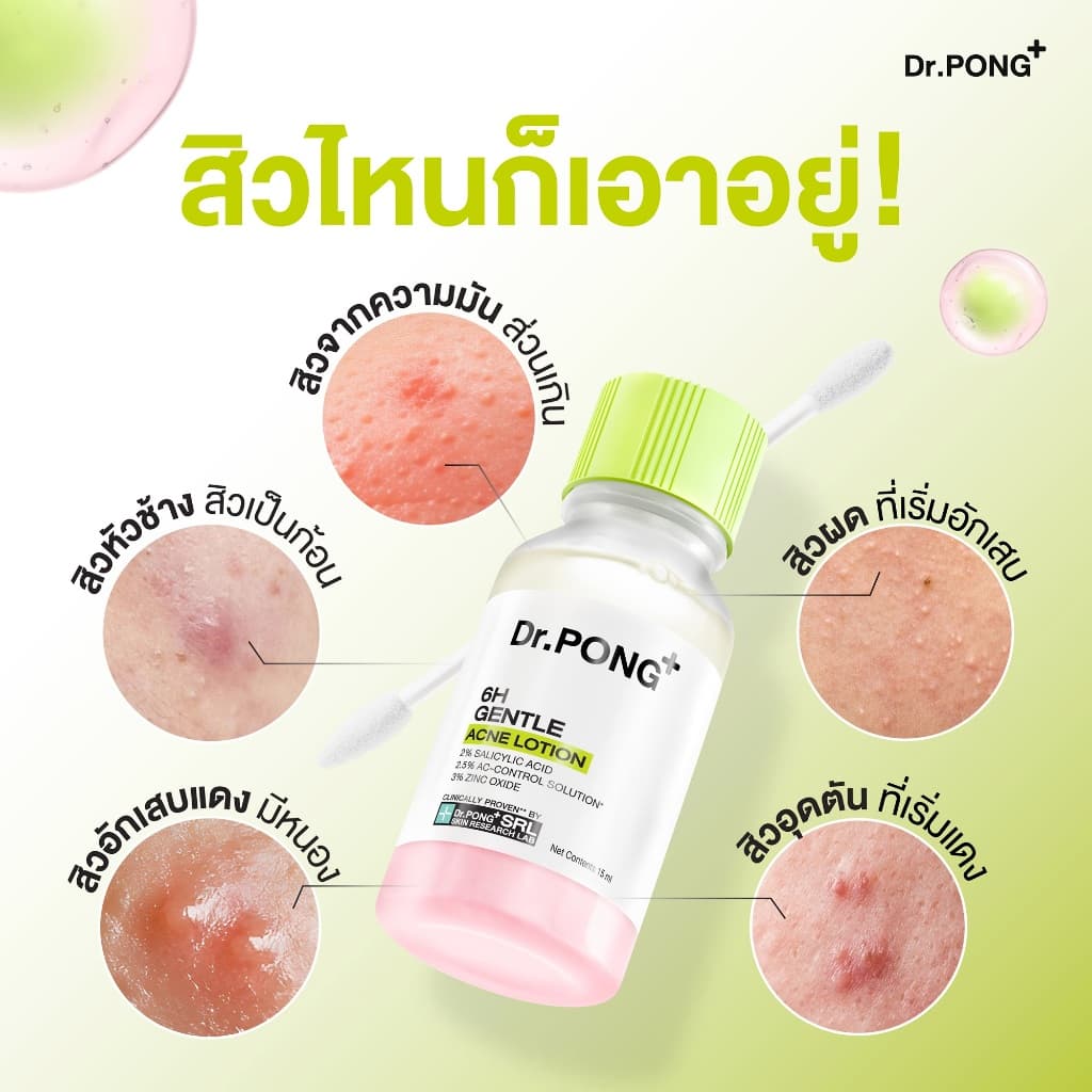 [3 ฟรี 1] Dr.PONG 6H GENTLE ACNE LOTION แป้งน้ำแต้มสิว สิวยุบใน 1 คืน แห้งไว ไม่ทิ้งรอย ไม่ขึ้บนซ้ำ